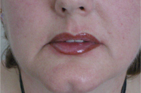  Pernanent Makeup Lip Blend After