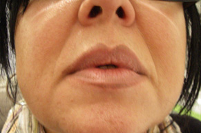   Pernanent Lip Makeup After